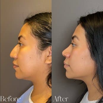 Plastic Cosmetic Surgery Near Me Boston Massachusetts