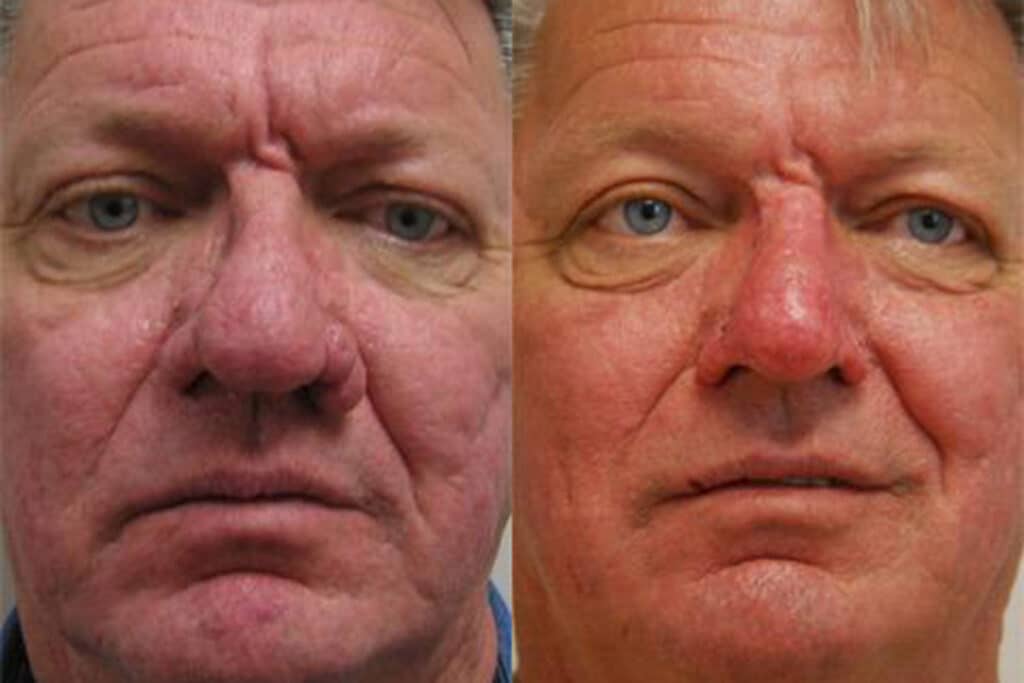 Plastic Cosmetic Surgery Near Me Cincinnati Ohio