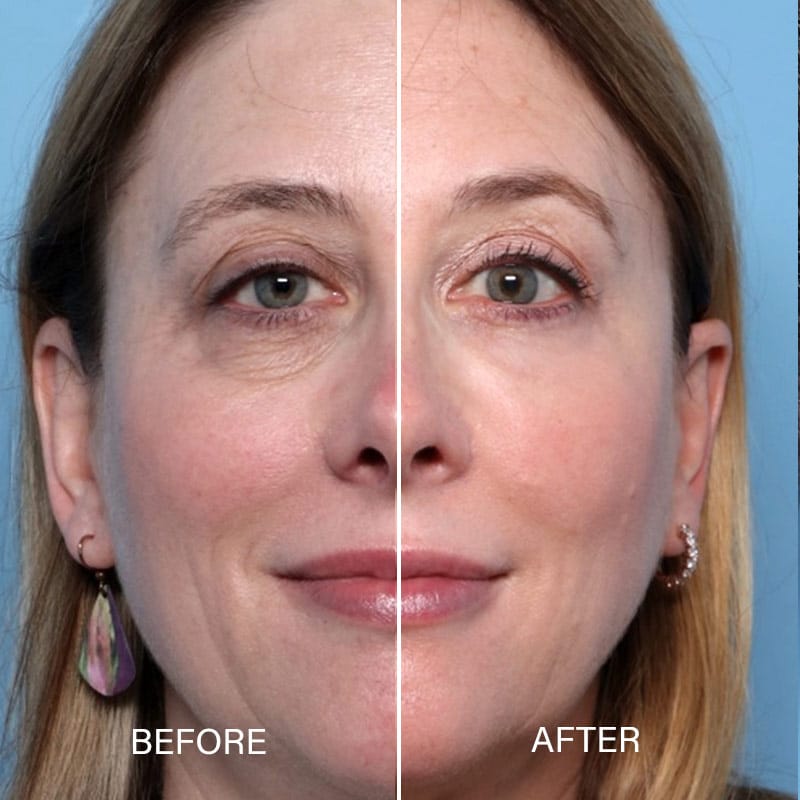 Plastic Cosmetic Surgery Near Me Columbus Ohio