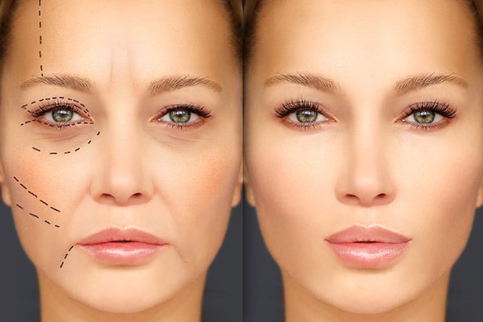 Cosmetic Surgery and Mental Health: The Connection Explored