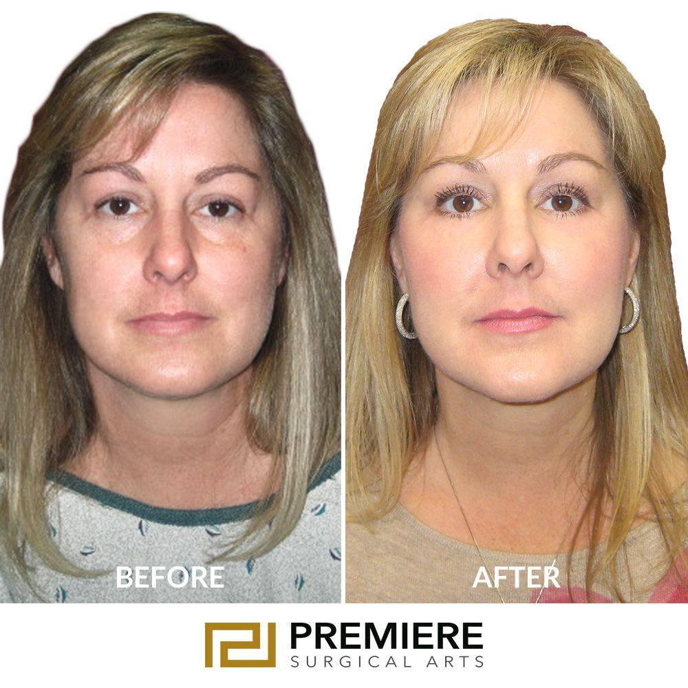 Plastic Cosmetic Surgery Near Me Houston Texas