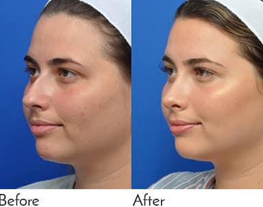Plastic Cosmetic Surgery Near Me Jacksonville Florida