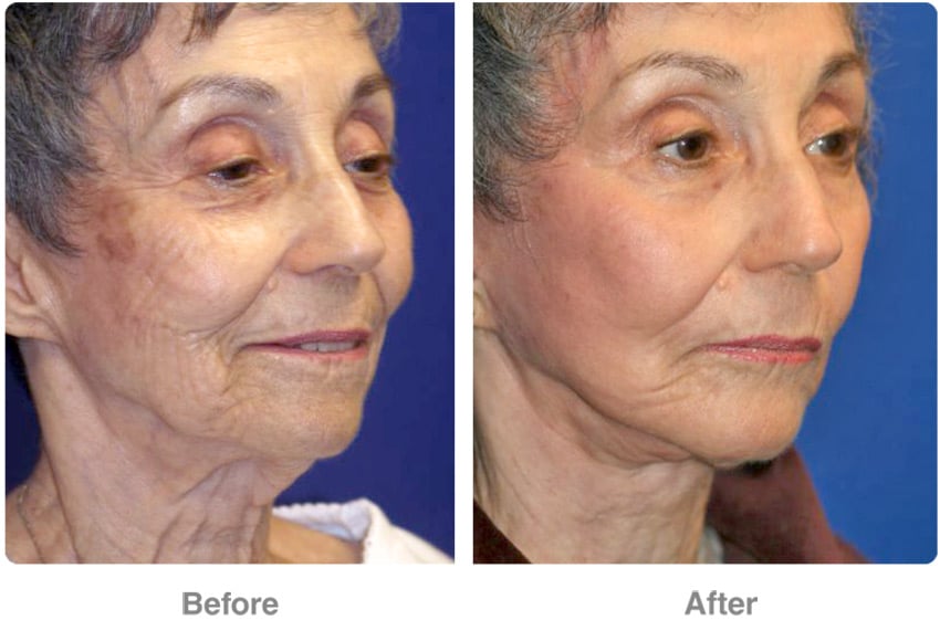 Plastic Cosmetic Surgery Near Me Las Vegas Nevada