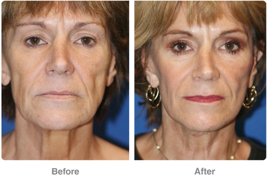 Plastic Cosmetic Surgery Near Me Las Vegas Nevada