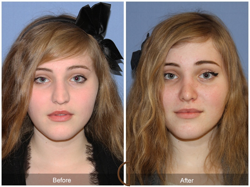 Plastic Cosmetic Surgery Near Me Long Beach California
