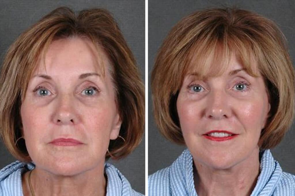 Plastic Cosmetic Surgery Near Me Omaha Nebraska Plastic Cosmetic Surgery Near Me Omaha Nebraska