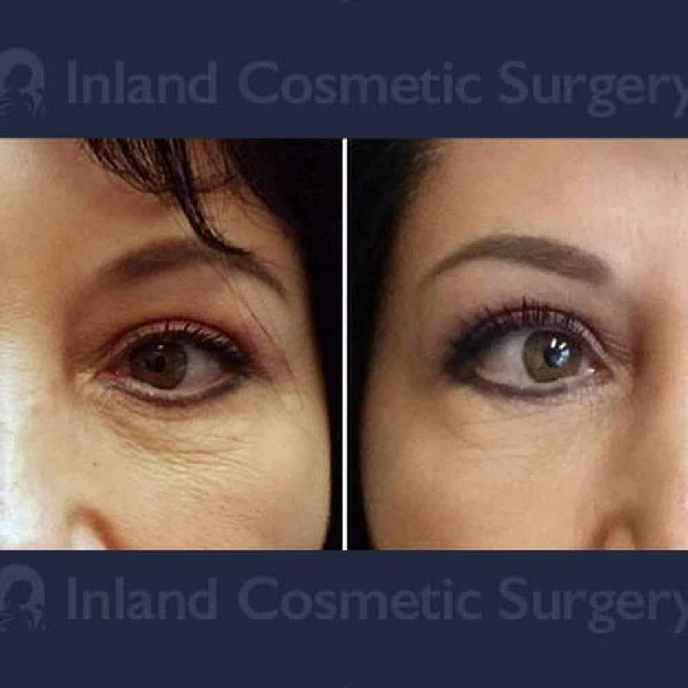 Plastic Cosmetic Surgery Near Me Riverside California Plastic Cosmetic Surgery Near Me Riverside California