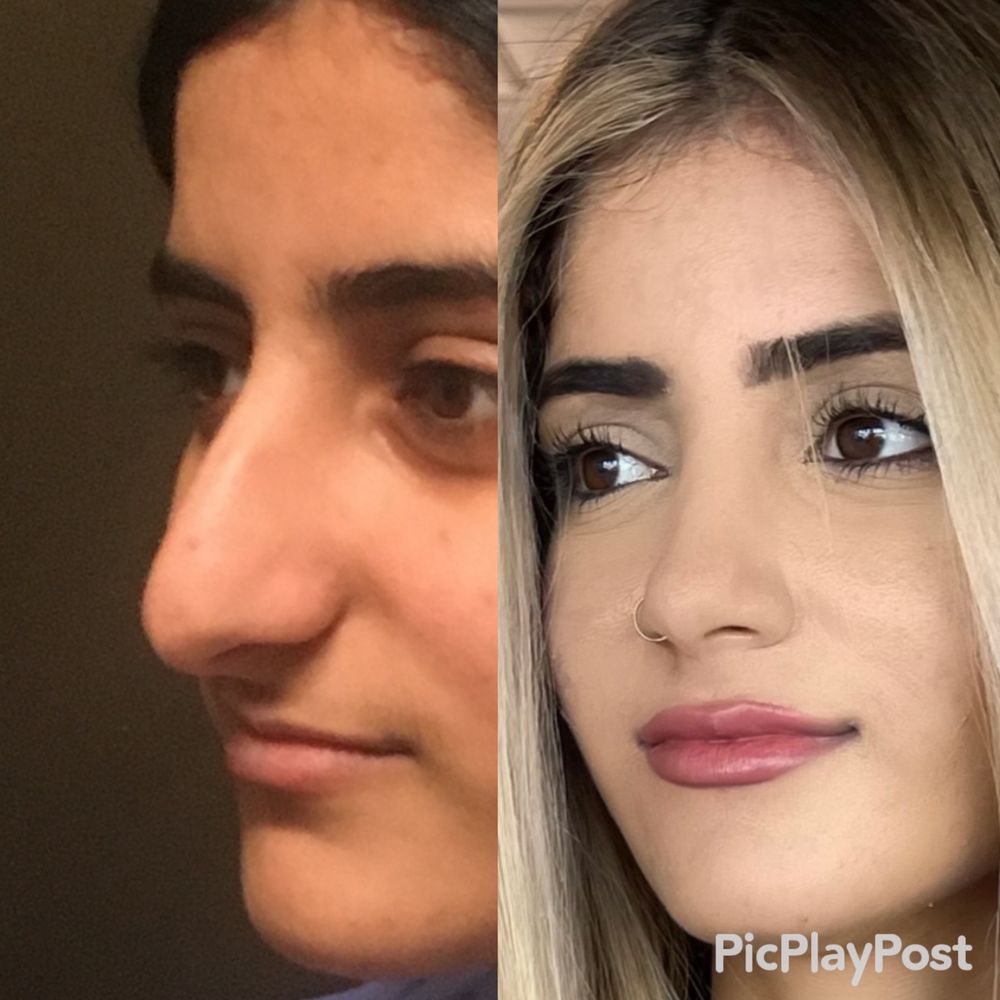 Plastic Cosmetic Surgery Near Me San Diego California