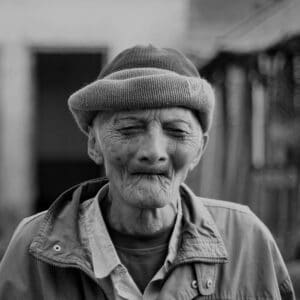 Photo Wrinkle reduction