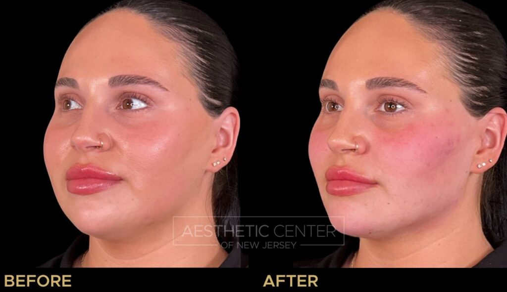 Facial Harmony Balancing Facial Harmony Balancing