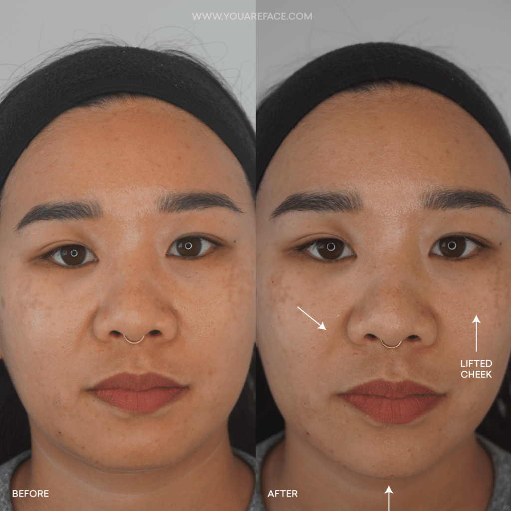 Facial Harmony Balancing Facial Harmony Balancing