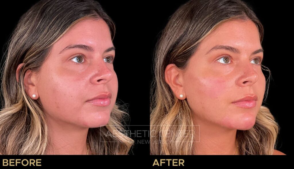 Facial Harmony Balancing Facial Harmony Balancing