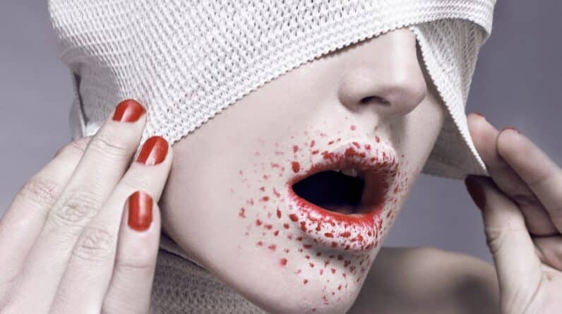 Photo "Plastic Surgery for Scar Revision and Removal"