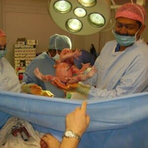 Photo Reproductive Organ Reconstruction Procedure