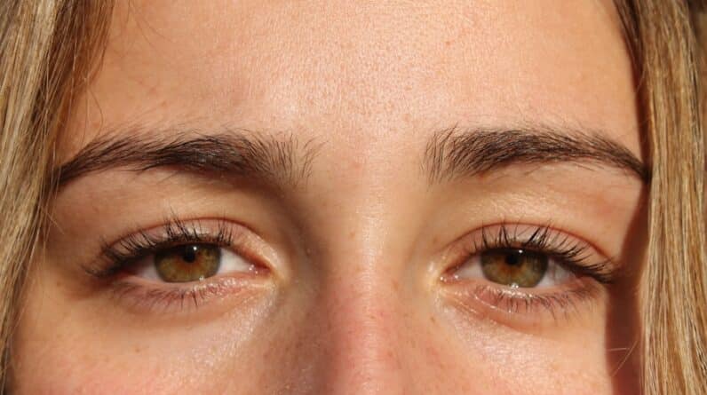Photo "What Are the Differences Between Open and Closed Rhinoplasty Techniques?"