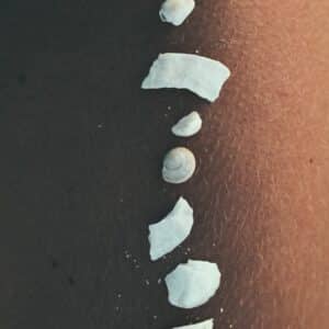 Photo Saline Implants Procedure