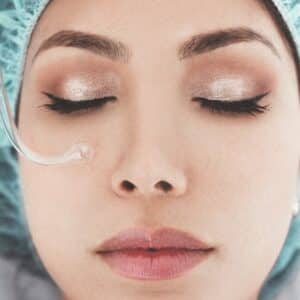 Photo Septoplasty Procedure