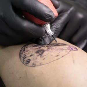 Photo Tribal Scarification Reconstruction Procedure