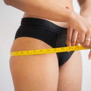 Photo "Liposuction vs Tummy Tucks: Which is Right for You?"