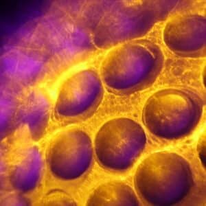 Photo Stem Cell Skin Regeneration Procedure