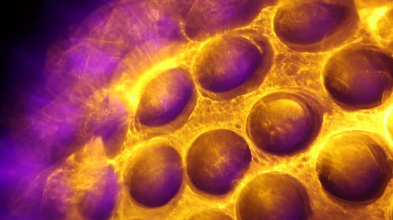 Photo Stem Cell Skin Regeneration Procedure