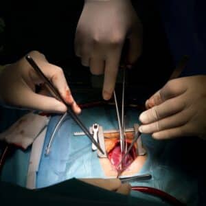 Photo Surgical tools