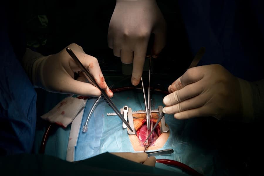 Tummy Tuck Surgeon