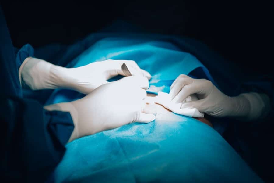 Body Contouring Plastic Surgeon