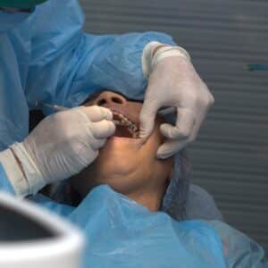 Photo Facelift Surgeon