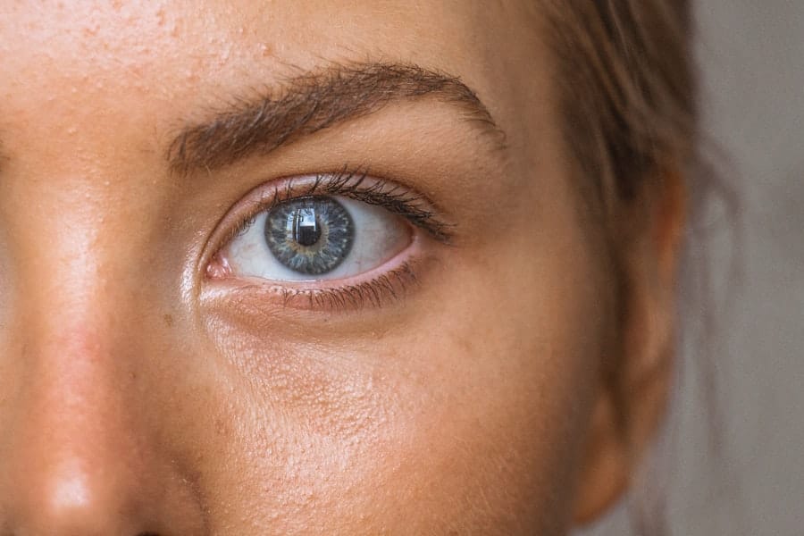 Eyelid Surgery