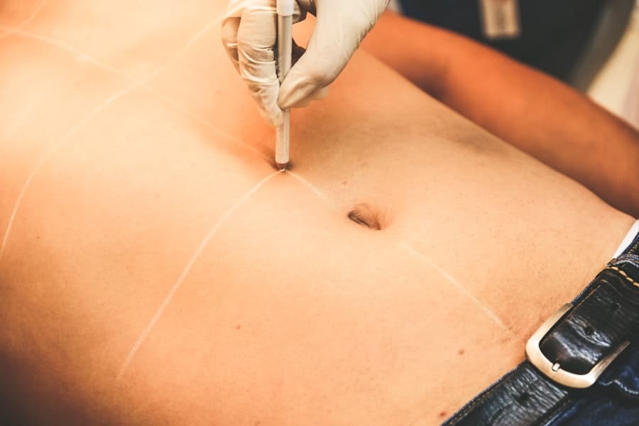 Body Sculpting Surgery