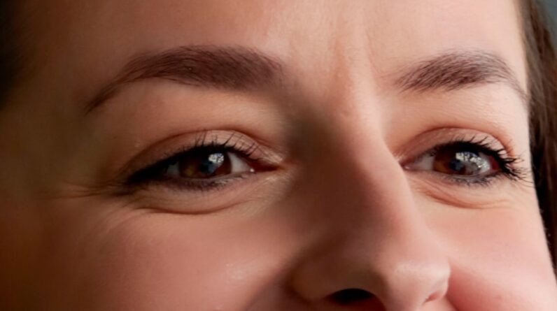 Photo Eyelid Lift Surgery