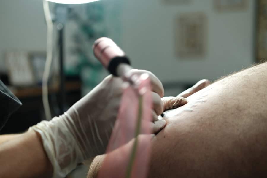 Photo Body Contouring Surgery