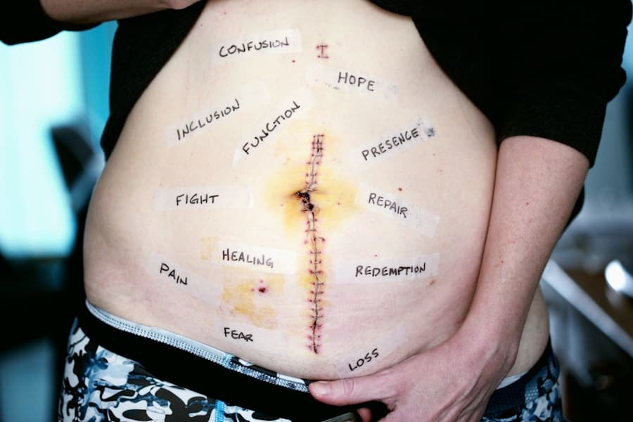 Photo Body Contouring Surgery