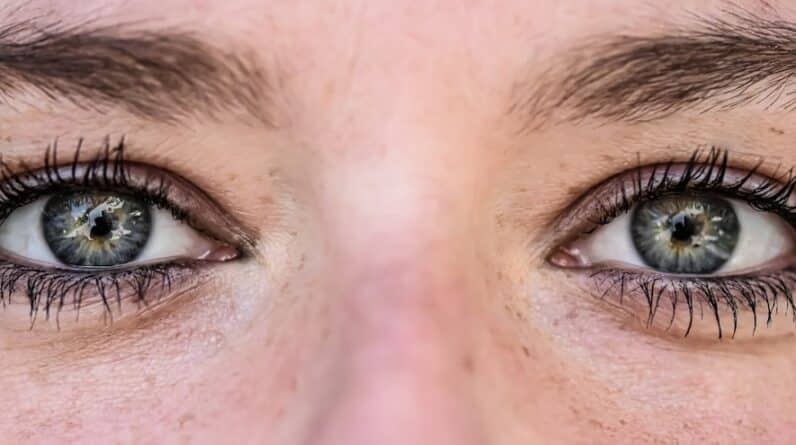 Photo Eyelid Surgery