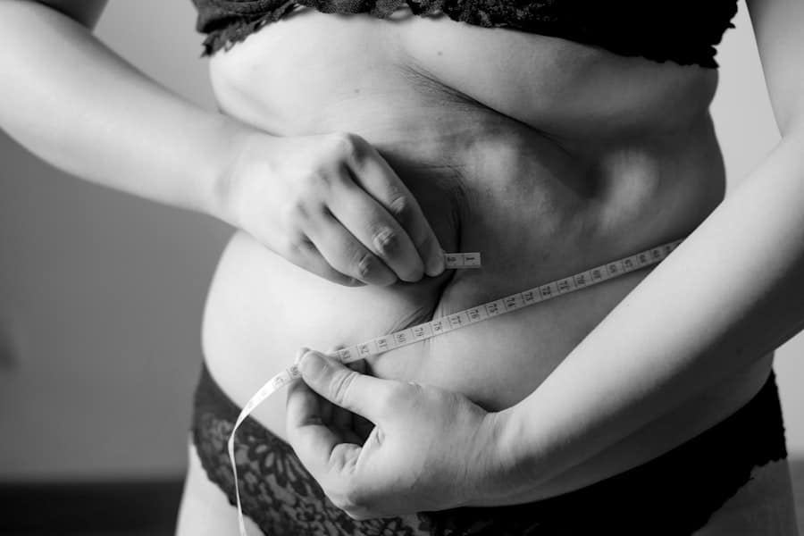 Photo Body Sculpting Surgery