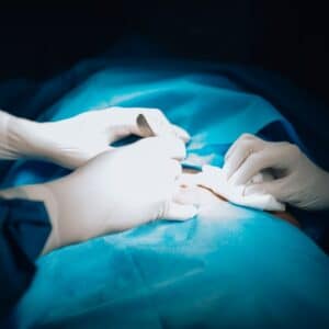Photo Breast Augmentation Surgeon